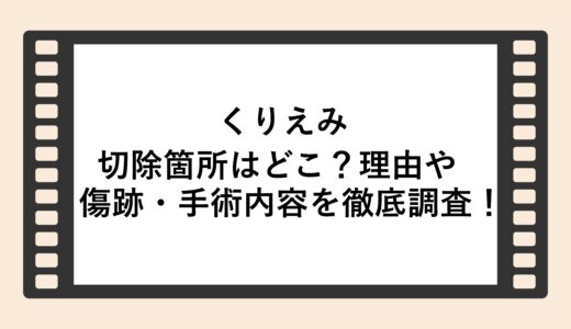 くりえみの切除箇所はどこ？理由や傷跡・手術内容を徹底調査！